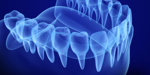 Image of a jaw