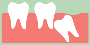 wisdom tooth growing in